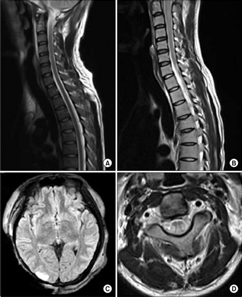 cervical spine mri results interpretation|Magnetic Resonance Imaging of the Cervical Spine.